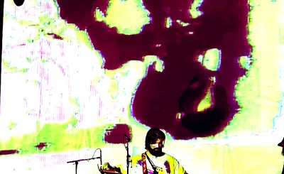 Turnover